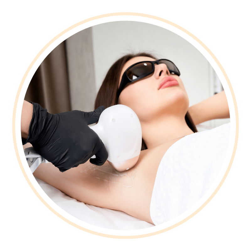 epilazione laser nettuno
